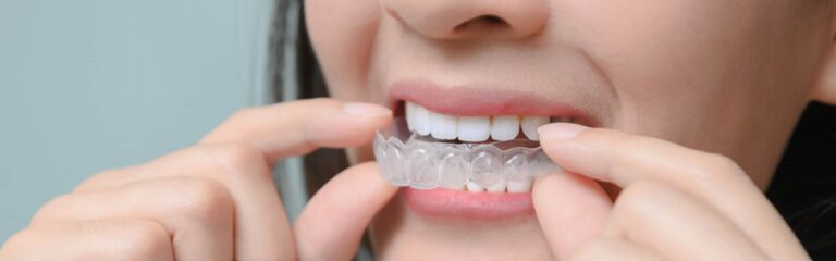 Descubre la ortodoncia invisible y sus ventajas